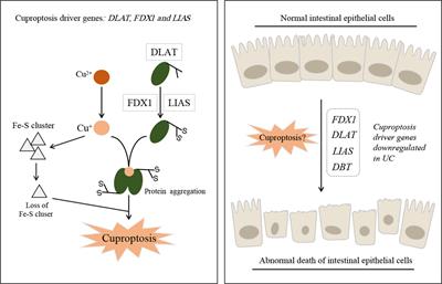 Commentary: Identification of cuproptosis hub genes contributing to the immune microenvironment in ulcerative colitis using bioinformatic analysis and experimental verification